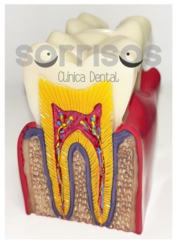 Apicectomía en el tratamiento de la infección dental. - Imagen 4