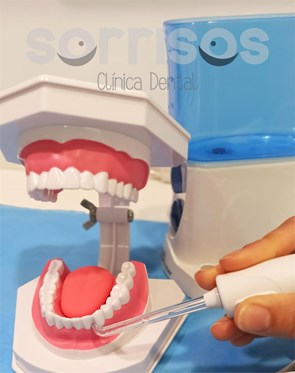 Cepillado dental de dientes naturales y de prótesis fija sobre implantes - Imagen 4