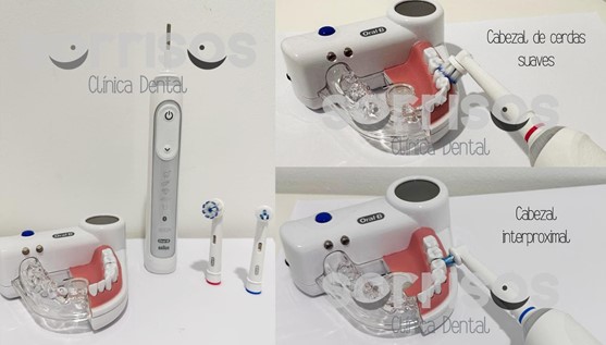 Cepillado dental de dientes naturales y de prótesis fija sobre implantes - Imagen 13