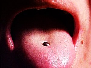 Piercings bucales y ortodoncia