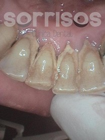 ¿Por qué se mueven los dientes? - Imagen 19