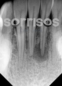 ¿Por qué se mueven los dientes? - Imagen 12