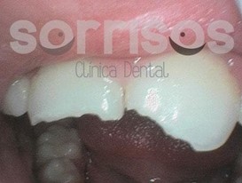 ¿Por qué se mueven los dientes? - Imagen 11